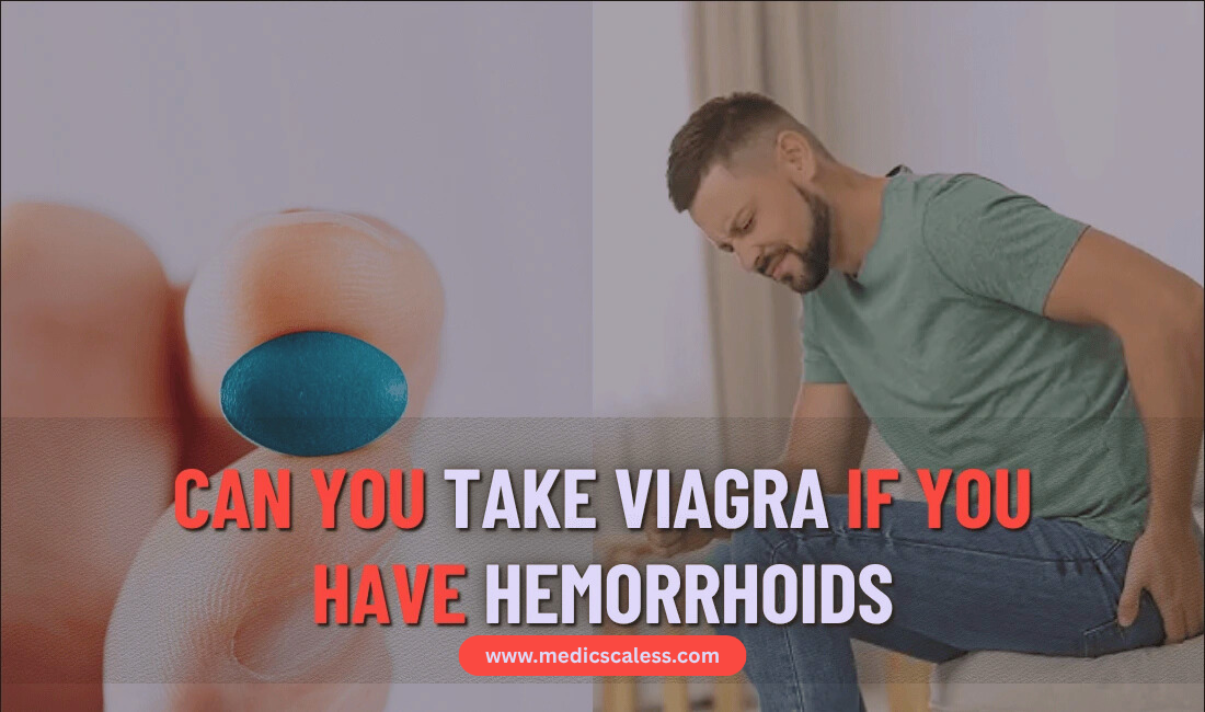 Hemorrhoids
