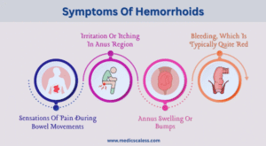 Can You Take Viagra if You Have Hemorrhoids? Symptoms Of Hemorrhoids
