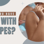 sex with herpes