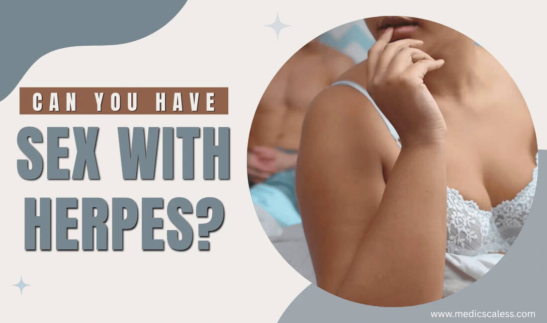 sex with herpes